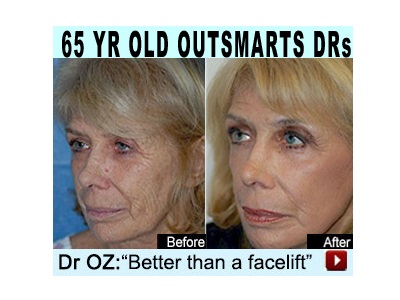 NaturaCel – Free Trial (Expired)